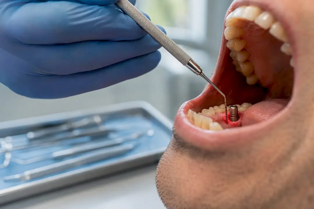 Clinician probing peri-implant tissue