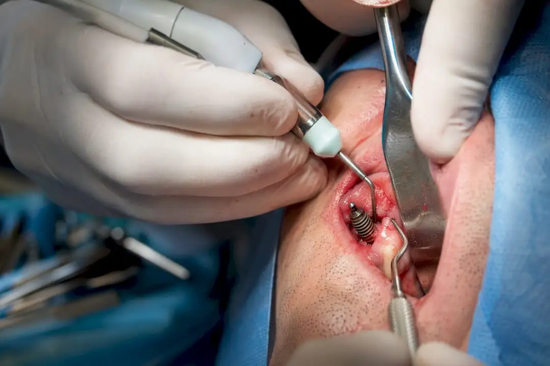 Surgeon using electrolytic cleaning device on implant