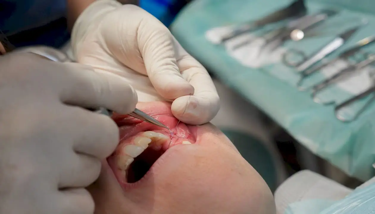Hands performing dental mattress suture