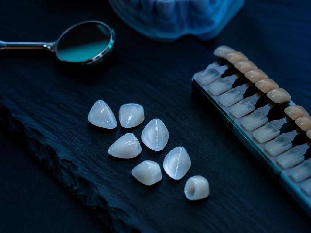 Porcelain veneers and a dental shade guide